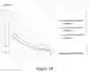 Fig. 16 - DEVICE TO ELECTROMAGNETICALLY STIMULATE NEW ORGANIC CELL PROLIFERATION