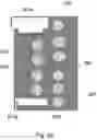 Fig. 09 - Radiotherapy apparatus