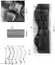 Fig. 06 - MATERIAL COVERING ADAPTED TO ADD WEIGHT TO A KETTLEBELL