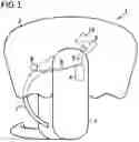 Fig. 02 - Avalanche airbag, method for manufacturing an avalanche airbag and avalanche airbag system