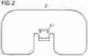 Fig. 03 - Avalanche airbag, method for manufacturing an avalanche airbag and avalanche airbag system