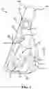 Fig. 04 - Iron-type golf club head with flex structure