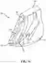 Fig. 10 - Iron-type golf club head with flex structure