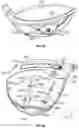 Fig. 35 - MULTI-PIECE GOLF CLUB HEAD