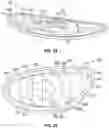 Fig. 20 - MULTI-PIECE GOLF CLUB HEAD