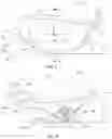 Fig. 04 - Golf club head