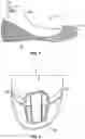 Fig. 02 - Skate with injected boot form