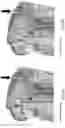 Fig. 56 - Metered and active sprayer devices with aerosol functionality—Flairosol II