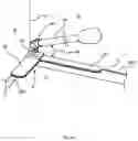 Fig. 05 - Reversible corner shield and methods of use
