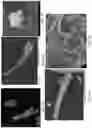 Fig. 15 - Metal macrostructures