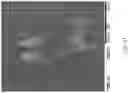 Fig. 23 - Metal macrostructures