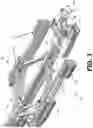Fig. 04 - Garment band attachment systems and methods