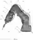 Fig. 05 - PROTECTIVE DRAPE FOR ROBOTIC SYSTEMS