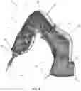 Fig. 06 - PROTECTIVE DRAPE FOR ROBOTIC SYSTEMS