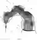 Fig. 07 - PROTECTIVE DRAPE FOR ROBOTIC SYSTEMS