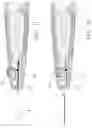 Fig. 11 - Utility knife