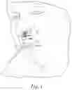 Fig. 02 - VENTED NOSE TRIMMER
