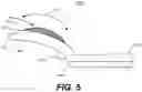 Fig. 05 - Vegetable slicing shield