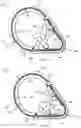 Fig. 06 - Rotatable cutting chain work tool, a wall saw arrangement comprising such a work tool, an annular member and a method for producing an annular member