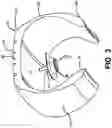 Fig. 04 - Integrated tread wear sensor and TPMS container for a tire