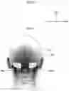 Fig. 05 - Vehicle seat, headrest, and head support member