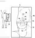 Fig. 02 - Airbag for vehicle