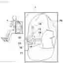 Fig. 03 - Airbag for vehicle