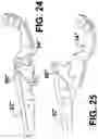 Fig. 25 - ACTIVE PEDESTRIAN HOOD HINGE WITH INTEGRATED LATCH ASSEMBLY