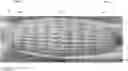 Fig. 01 - Outer membrane for aerial vehicles