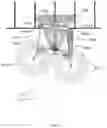 Fig. 04 - Aircraft landing gear assembly