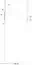 Fig. 14 - Tamper Evident Bag Seal