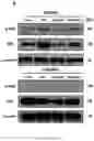 Fig. 24 - Using adiponectin receptor agonists to treat inflammation and bone diseases in diabetes