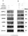 Fig. 25 - Using adiponectin receptor agonists to treat inflammation and bone diseases in diabetes