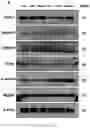 Fig. 27 - Using adiponectin receptor agonists to treat inflammation and bone diseases in diabetes