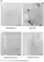 Fig. 55 - Using adiponectin receptor agonists to treat inflammation and bone diseases in diabetes