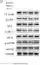Fig. 67 - Using adiponectin receptor agonists to treat inflammation and bone diseases in diabetes
