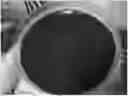 Fig. 01 - MEDIUM FOR PRIMARY ISOLATION OF PORPHYROMONAS GINGIVALIS, AND A MEDIUM FOR PREPARING THE MEDIUM AND USE THEREOF