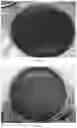 Fig. 04 - MEDIUM FOR PRIMARY ISOLATION OF PORPHYROMONAS GINGIVALIS, AND A MEDIUM FOR PREPARING THE MEDIUM AND USE THEREOF
