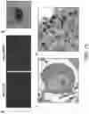 Fig. 12 - METHOD OF NOCICEPTOR DIFFERENTIATION OF HUMAN EMBRYONIC STEM CELLS AND USES THEREOF