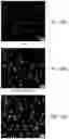 Fig. 34 - NOVEL GLIA-LIKE CELLS DIFFERENATIATED FROM SOMATIC CELLS, PREPARATION METHOD THEREFOR, COCKTAIL COMPOSITION FOR PREPARING SAME, CELL THERAPEUTIC AGENT FOR PREVENTING OR TREATING NEUROLOGICAL DISORDERS, COMPRISING SAME, AND METHOD FOR PREVENTING AND TREATING NEUROLOGICAL DISORDERS BY ADMINISTERING SAME