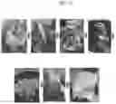 Fig. 14 - COMPOSITIONS AND METHODS FOR EXTRACTION OF MESENCHYMAL STEM CELLS