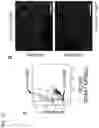 Fig. 18 - METHOD FOR INDUCING DIFFERENTIATION OF ALVEOLAR EPITHELIAL CELLS