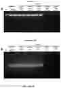 Fig. 21 - METHODS FOR NUCLEIC ACID CAPTURE