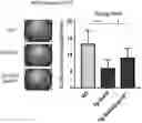 Fig. 01 - MODULATING BONE MORPHOGENIC PROTEIN (BMP) SIGNALING IN THE TREATMENT OF ALZHEIMER'S DISEASE
