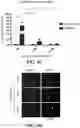 Fig. 16 - MODULATING BONE MORPHOGENIC PROTEIN (BMP) SIGNALING IN THE TREATMENT OF ALZHEIMER'S DISEASE