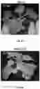 Fig. 09 - ROSE ROSETTE VIRUS INFECTIOUS CLONES AND USES THEREOF