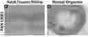 Fig. 01 - DUAL EXPRESSION VECTOR FOR GENE AUGMENTATION FOR CRUMBS COMPLEX HOMOLOGUE 1 (CRB1) MUTATIONS