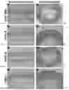 Fig. 03 - DUAL EXPRESSION VECTOR FOR GENE AUGMENTATION FOR CRUMBS COMPLEX HOMOLOGUE 1 (CRB1) MUTATIONS