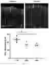Fig. 15 - DUAL EXPRESSION VECTOR FOR GENE AUGMENTATION FOR CRUMBS COMPLEX HOMOLOGUE 1 (CRB1) MUTATIONS