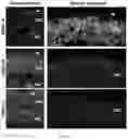 Fig. 16 - DUAL EXPRESSION VECTOR FOR GENE AUGMENTATION FOR CRUMBS COMPLEX HOMOLOGUE 1 (CRB1) MUTATIONS